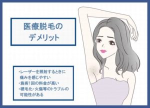 医療脱毛のデメリット